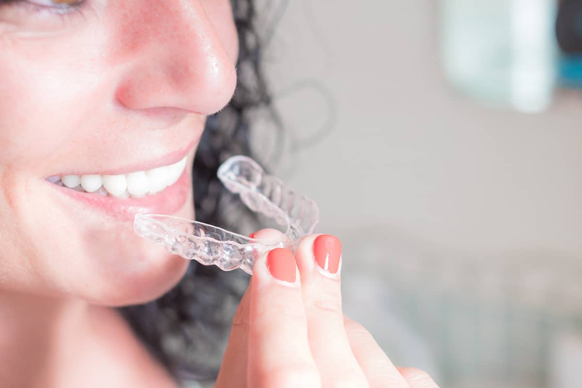 How Much Does Invisalign Cost in Midtown NYC?