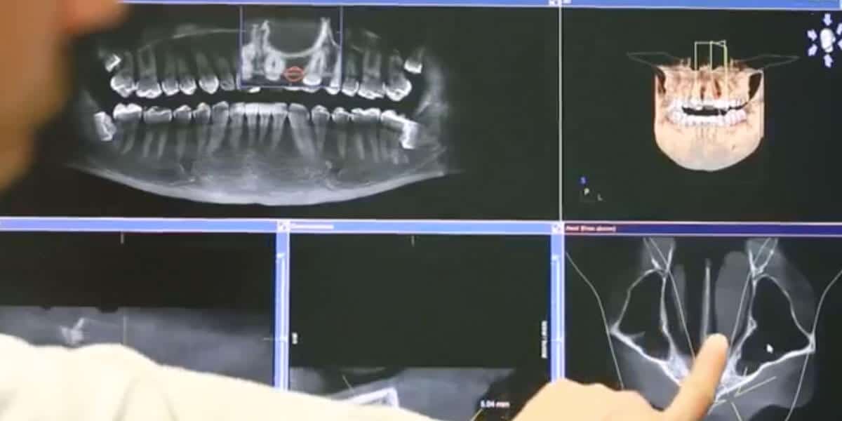 Cone Beam Scanner