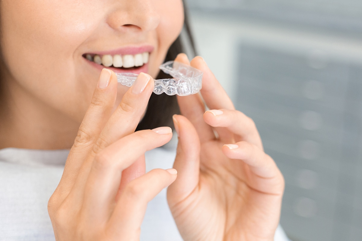 How Long Does Invisalign Take to Straighten Teeth?