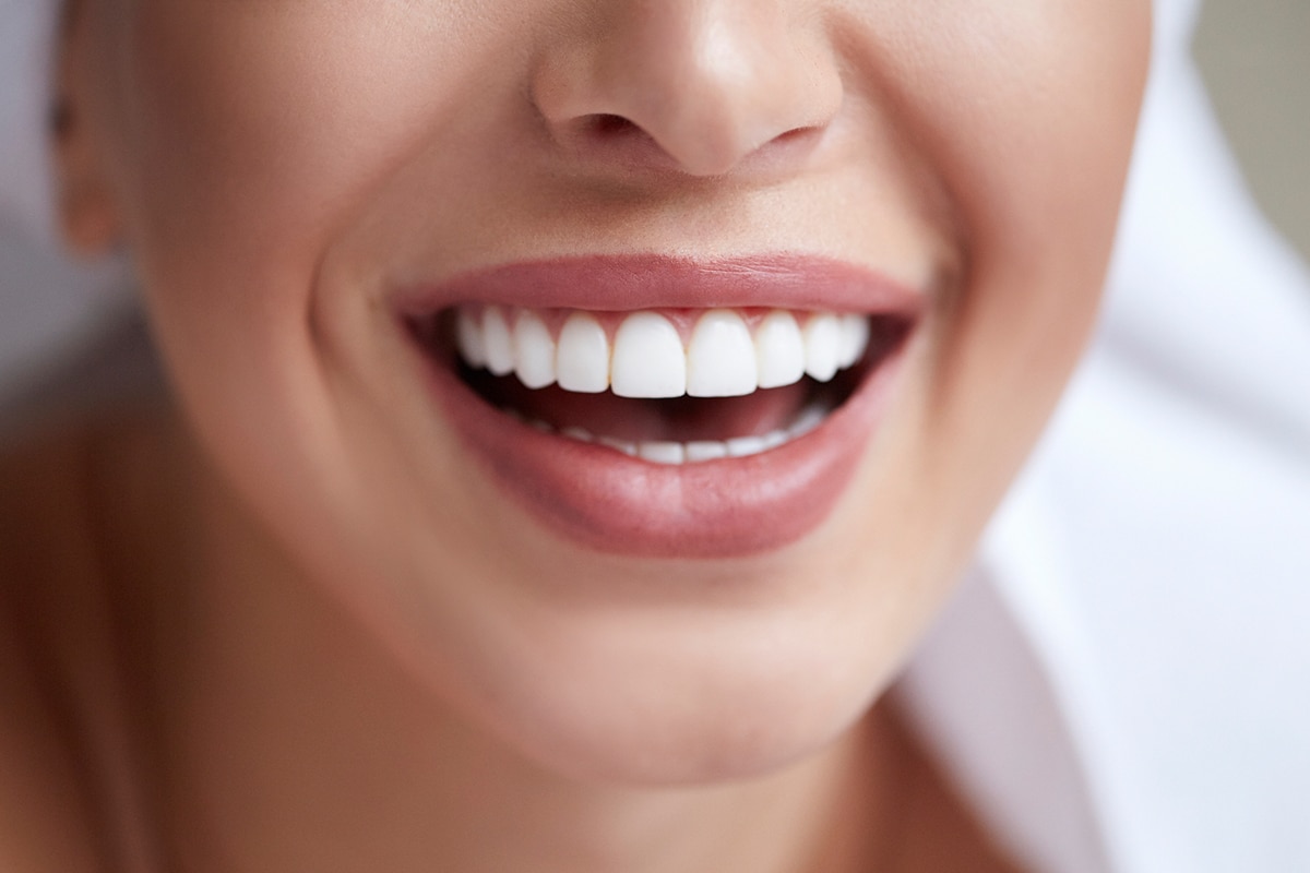 Natural Remedies for White Teeth